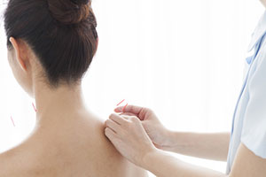 はり・きゅうはココがスゴイ！